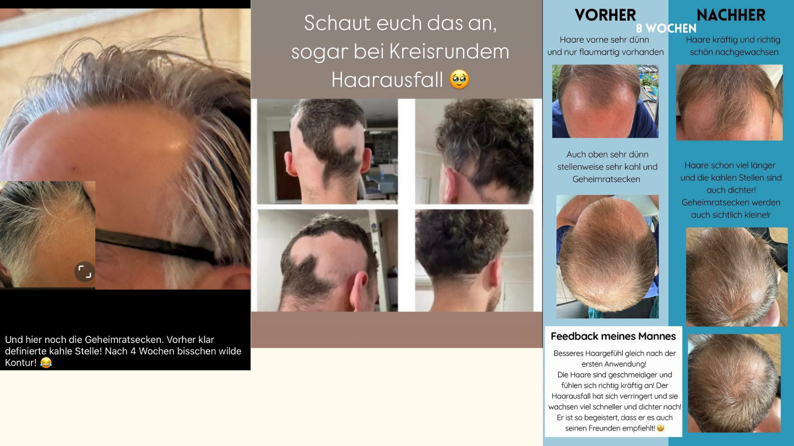 Monat_Haarprodukte_erfahrungsbericht_Maenner